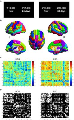 Different topological patterns in structural covariance networks between high and low delay discounters